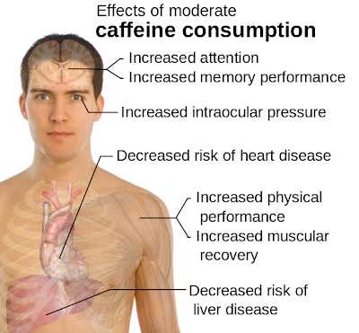 Caffeine intoxication
